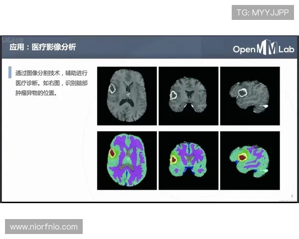 杭州足球队快攻战术解析与实战应用探讨